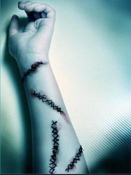 Mes blessures se réouvres